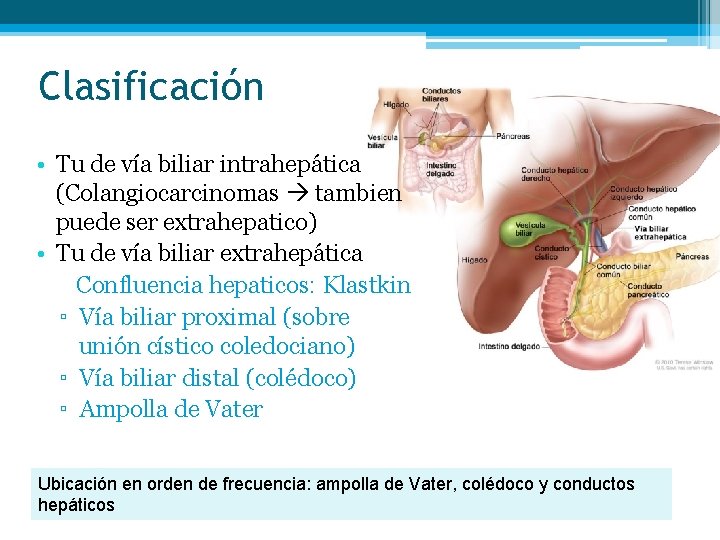 Clasificación • Tu de vía biliar intrahepática (Colangiocarcinomas tambien puede ser extrahepatico) • Tu