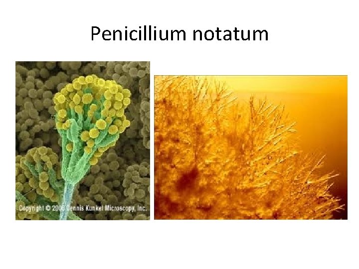 Penicillium notatum 