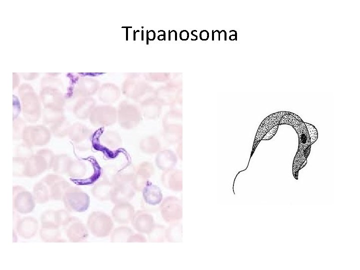 Tripanosoma 