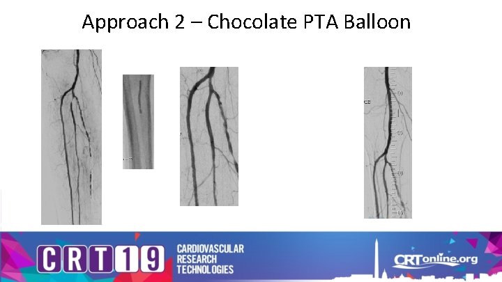 Approach 2 – Chocolate PTA Balloon 