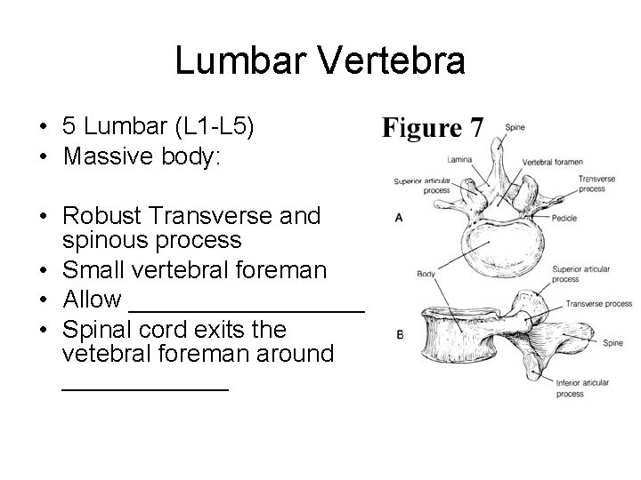 Lumbar Vertebra • 5 Lumbar (L 1 -L 5) • Massive body: • Robust