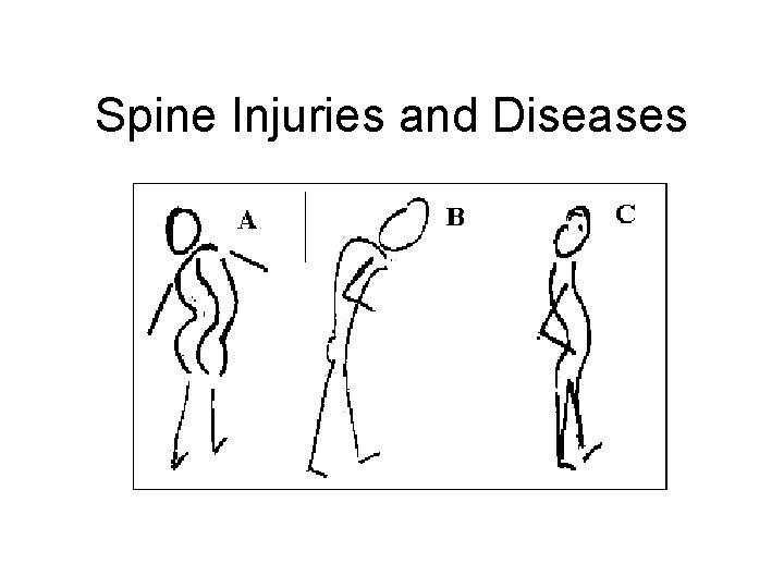 Spine Injuries and Diseases 