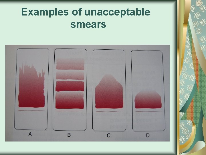 Examples of unacceptable smears 