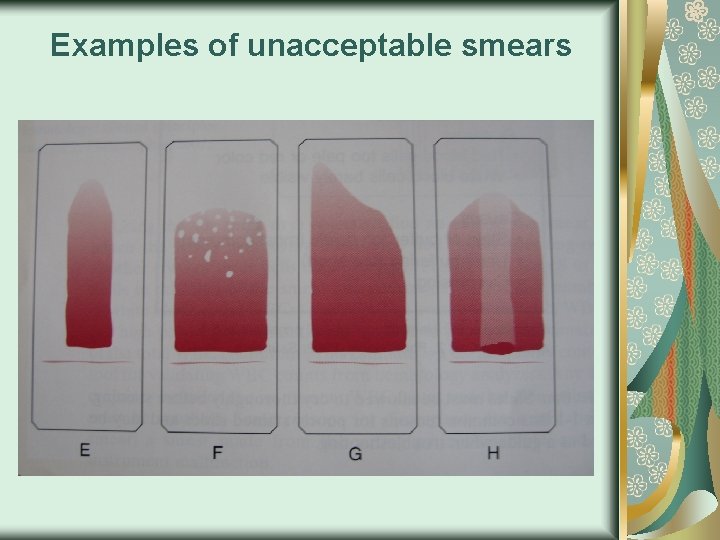 Examples of unacceptable smears 