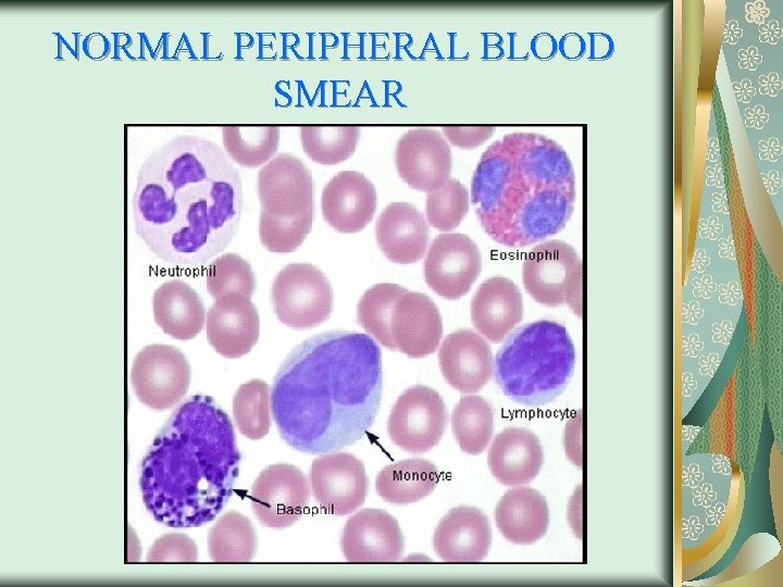 NORMAL PERIPHERAL BLOOD SMEAR 