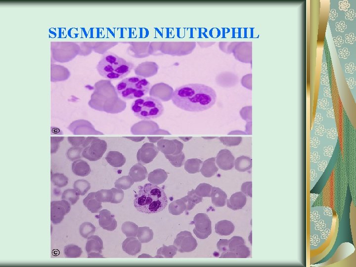 SEGMENTED NEUTROPHIL 