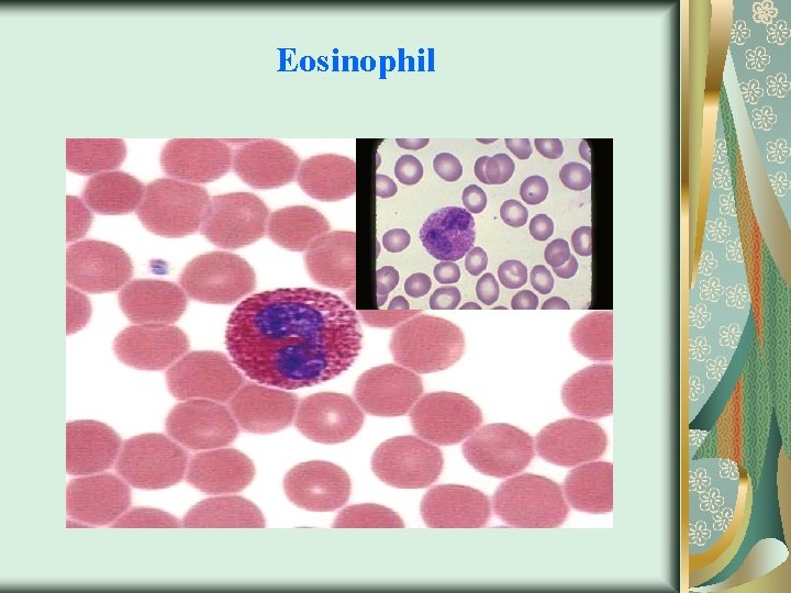 Eosinophil 