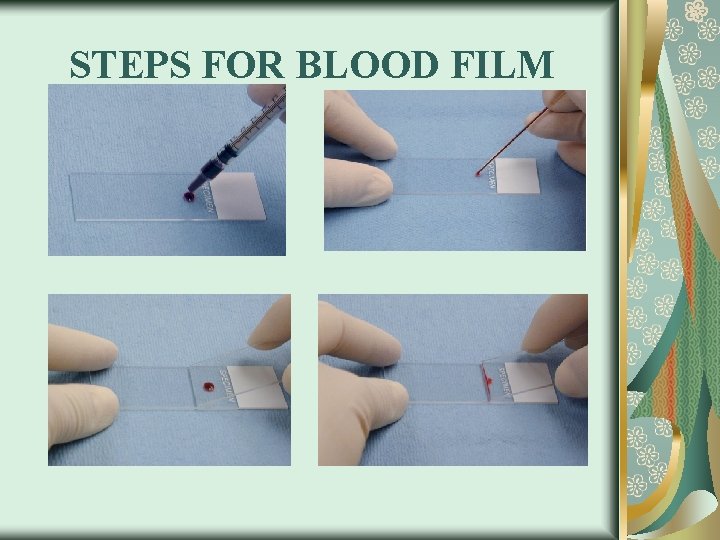 STEPS FOR BLOOD FILM 