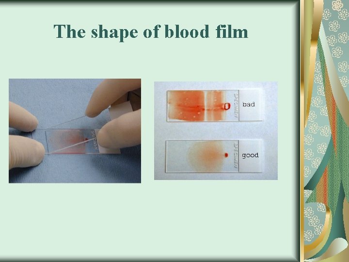 The shape of blood film 