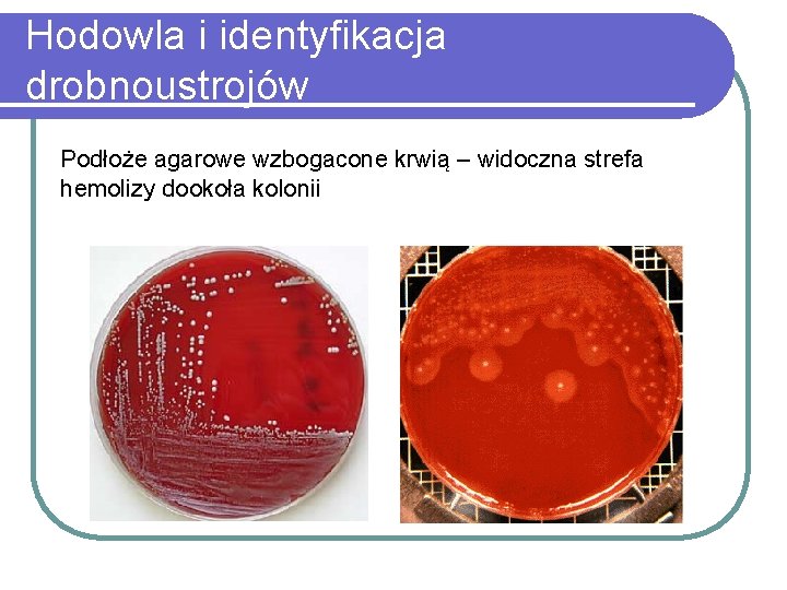 Hodowla i identyfikacja drobnoustrojów Podłoże agarowe wzbogacone krwią – widoczna strefa hemolizy dookoła kolonii