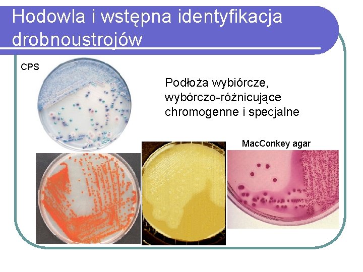 Hodowla i wstępna identyfikacja drobnoustrojów CPS Podłoża wybiórcze, wybórczo-różnicujące chromogenne i specjalne Mac. Conkey