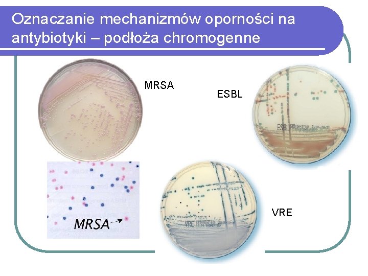 Oznaczanie mechanizmów oporności na antybiotyki – podłoża chromogenne MRSA ESBL VRE 