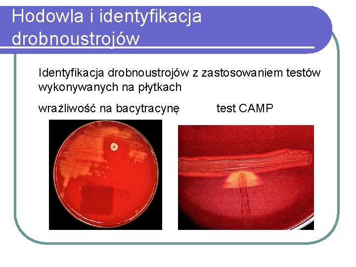 Hodowla i identyfikacja drobnoustrojów Identyfikacja drobnoustrojów z zastosowaniem testów wykonywanych na płytkach wrażliwość na