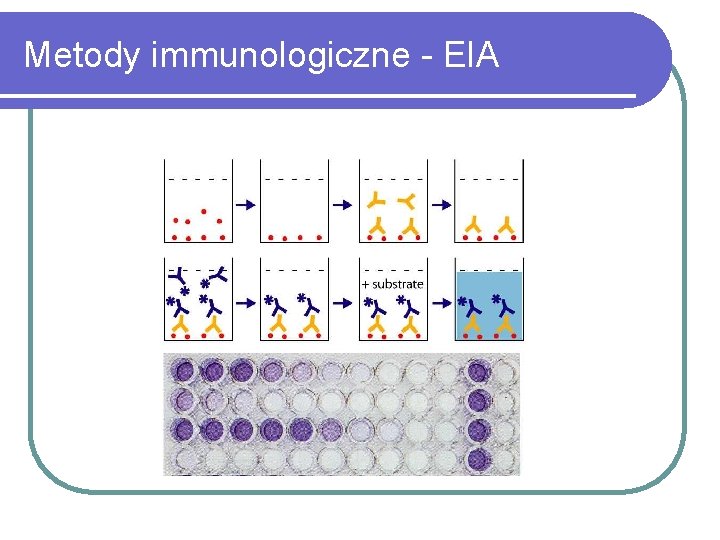 Metody immunologiczne - EIA 