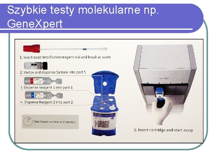 Szybkie testy molekularne np. Gene. Xpert 