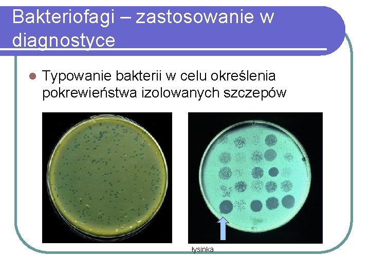 Bakteriofagi – zastosowanie w diagnostyce l Typowanie bakterii w celu określenia pokrewieństwa izolowanych szczepów