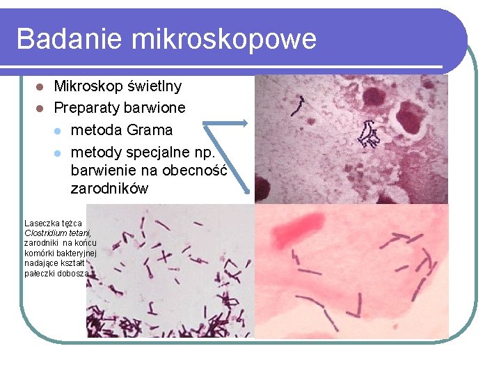 Badanie mikroskopowe Mikroskop świetlny l Preparaty barwione l metoda Grama l metody specjalne np.