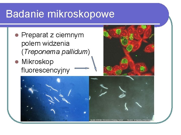 Badanie mikroskopowe Preparat z ciemnym polem widzenia (Treponema pallidum) l Mikroskop fluorescencyjny l 