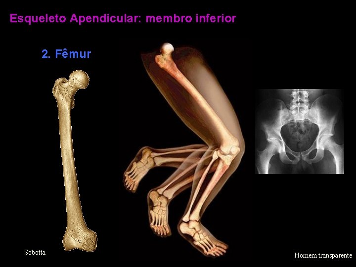 Esqueleto Apendicular: membro inferior 2. Fêmur Sobotta Homem transparente 