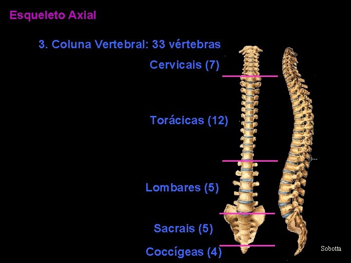 Esqueleto Axial 3. Coluna Vertebral: 33 vértebras Cervicais (7) Torácicas (12) Lombares (5) Sacrais