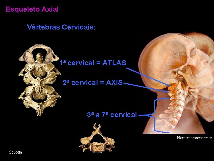 Esqueleto Axial Vértebras Cervicais: 1ª cervical = ATLAS 2ª cervical = AXIS 3ª a