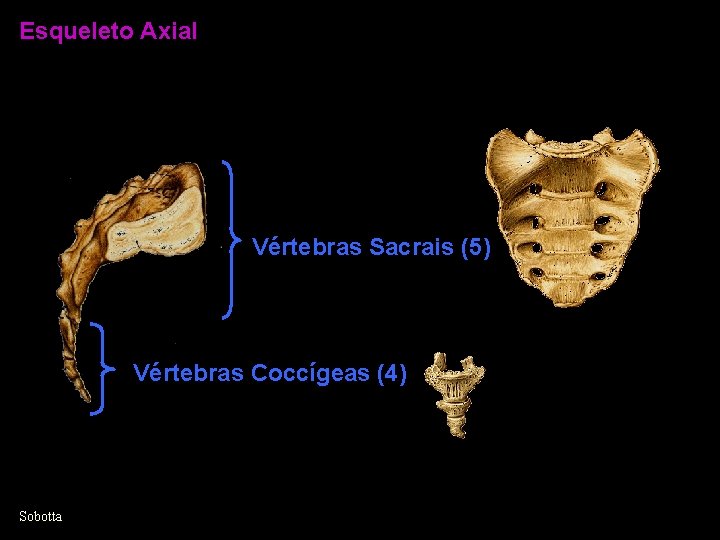 Esqueleto Axial Vértebras Sacrais (5) Vértebras Coccígeas (4) Sobotta 