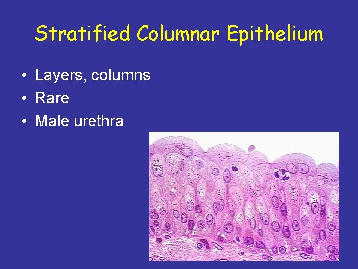 Stratified Columnar Epithelium • Layers, columns • Rare • Male urethra 