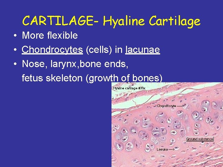 CARTILAGE- Hyaline Cartilage • More flexible • Chondrocytes (cells) in lacunae • Nose, larynx,