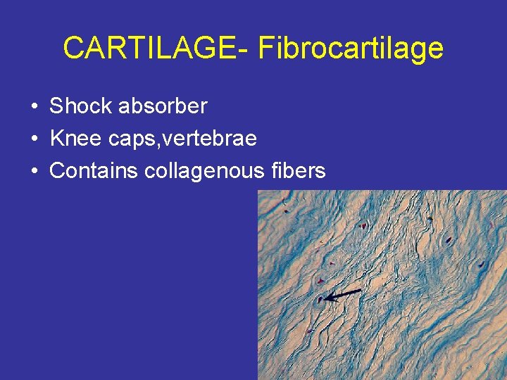 CARTILAGE- Fibrocartilage • Shock absorber • Knee caps, vertebrae • Contains collagenous fibers 