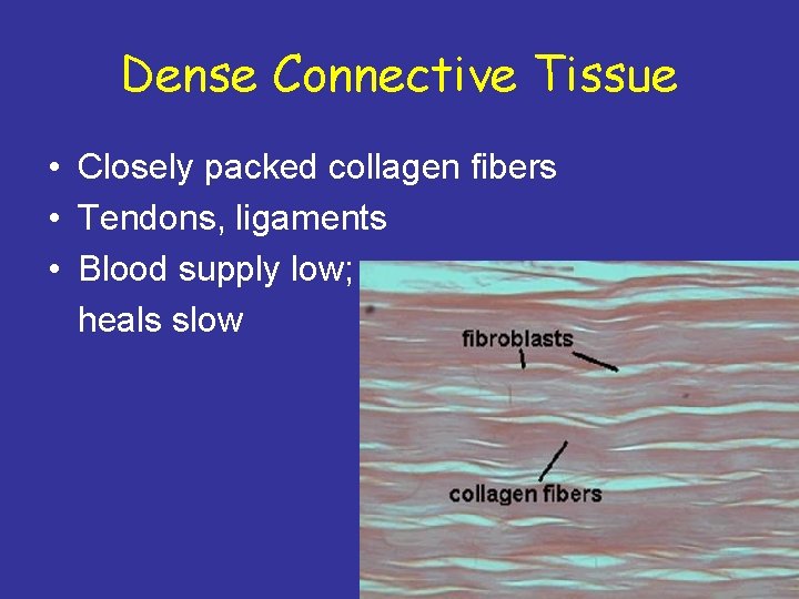 Dense Connective Tissue • Closely packed collagen fibers • Tendons, ligaments • Blood supply