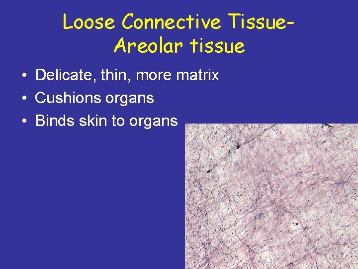 Loose Connective Tissue. Areolar tissue • Delicate, thin, more matrix • Cushions organs •