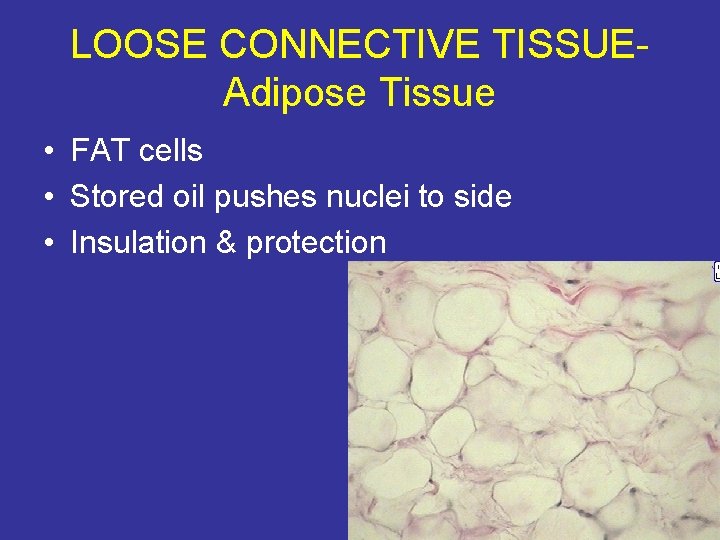 LOOSE CONNECTIVE TISSUEAdipose Tissue • FAT cells • Stored oil pushes nuclei to side