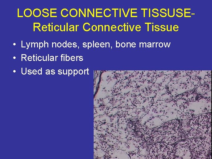 LOOSE CONNECTIVE TISSUSEReticular Connective Tissue • Lymph nodes, spleen, bone marrow • Reticular fibers