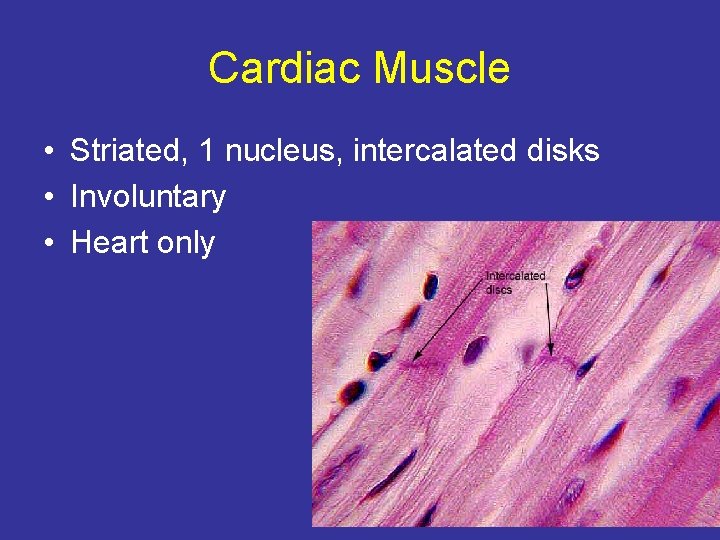 Cardiac Muscle • Striated, 1 nucleus, intercalated disks • Involuntary • Heart only 