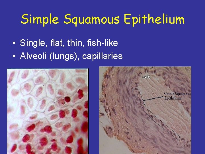 Simple Squamous Epithelium • Single, flat, thin, fish-like • Alveoli (lungs), capillaries 