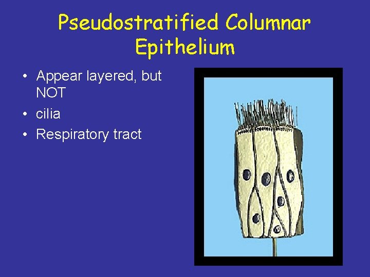 Pseudostratified Columnar Epithelium • Appear layered, but NOT • cilia • Respiratory tract 