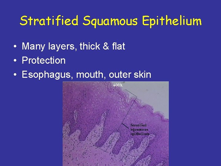 Stratified Squamous Epithelium • Many layers, thick & flat • Protection • Esophagus, mouth,