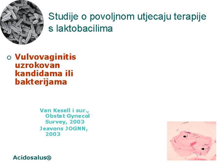 Studije o povoljnom utjecaju terapije s laktobacilima ¡ Vulvovaginitis uzrokovan kandidama ili bakterijama Van