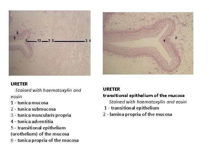 URETER Stained with haematoxylin and eosin 1 - tunica mucosa 2 - tunica submucosa