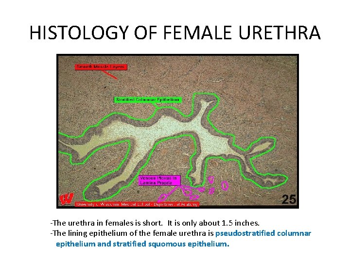 HISTOLOGY OF FEMALE URETHRA -The urethra in females is short. It is only about