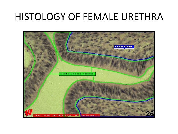 HISTOLOGY OF FEMALE URETHRA 