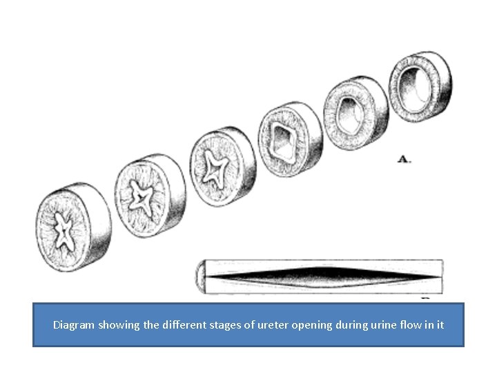 Diagram showing the different stages of ureter opening during urine flow in it 