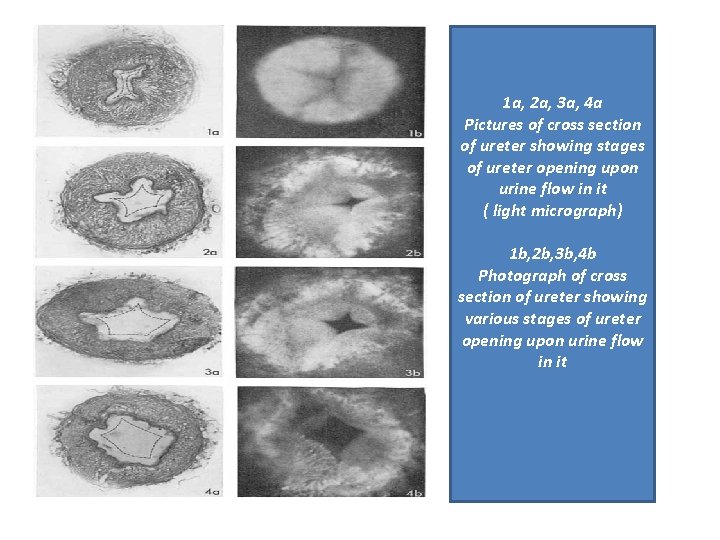 1 a, 2 a, 3 a, 4 a Pictures of cross section of ureter