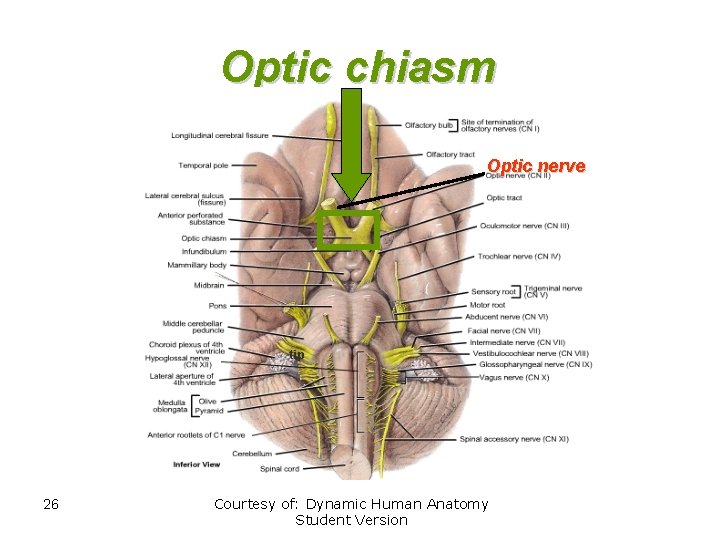 Optic chiasm Optic nerve tip 26 Courtesy of: Dynamic Human Anatomy Student Version 