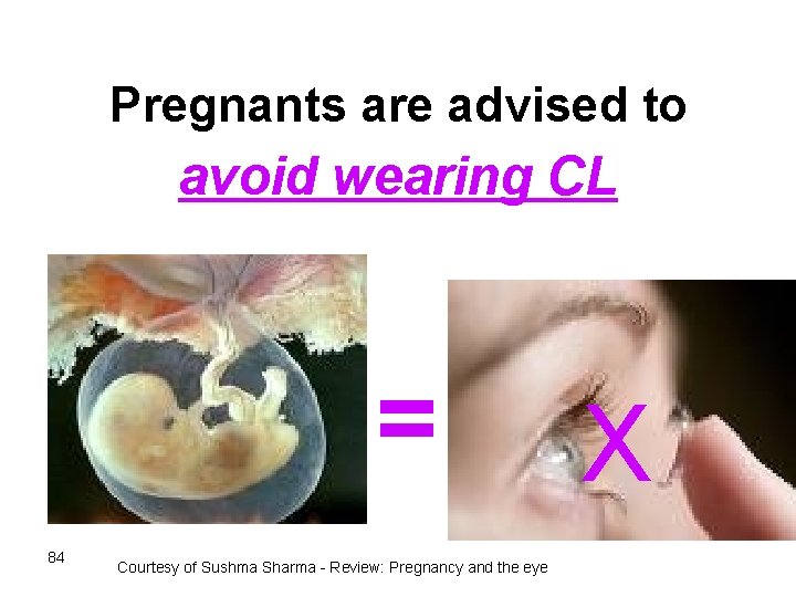 Pregnants are advised to avoid wearing CL = 84 Courtesy of Sushma Sharma -