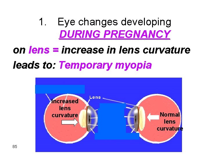 1. Eye changes developing DURING PREGNANCY on lens = increase in lens curvature leads