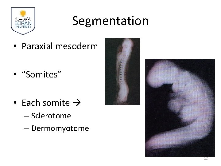 Segmentation • Paraxial mesoderm • “Somites” • Each somite – Sclerotome – Dermomyotome 12