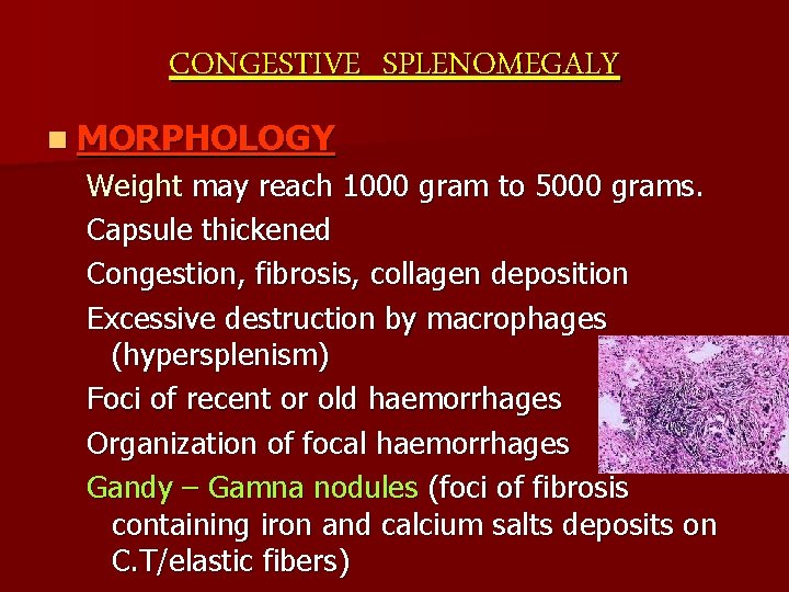 CONGESTIVE SPLENOMEGALY n MORPHOLOGY Weight may reach 1000 gram to 5000 grams. Capsule thickened