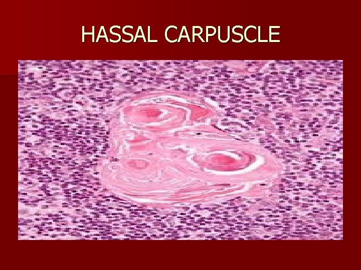 HASSAL CARPUSCLE 