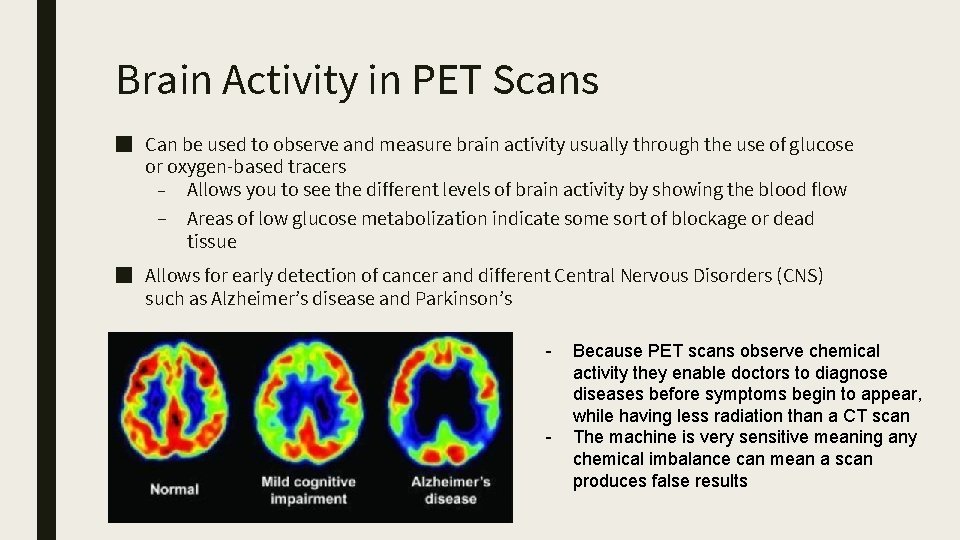 Brain Activity in PET Scans ■ Can be used to observe and measure brain